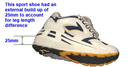 Orthopaedic shoe modifications image